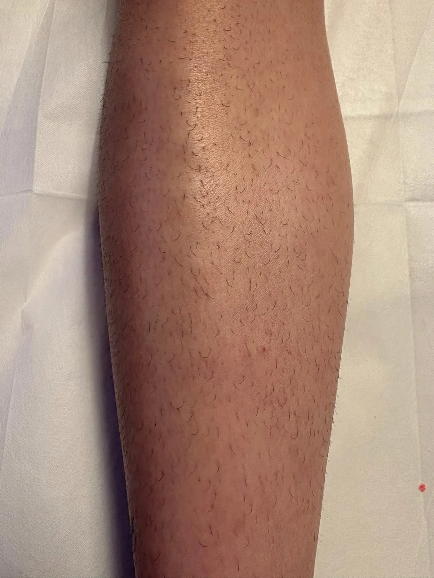 Calves, before