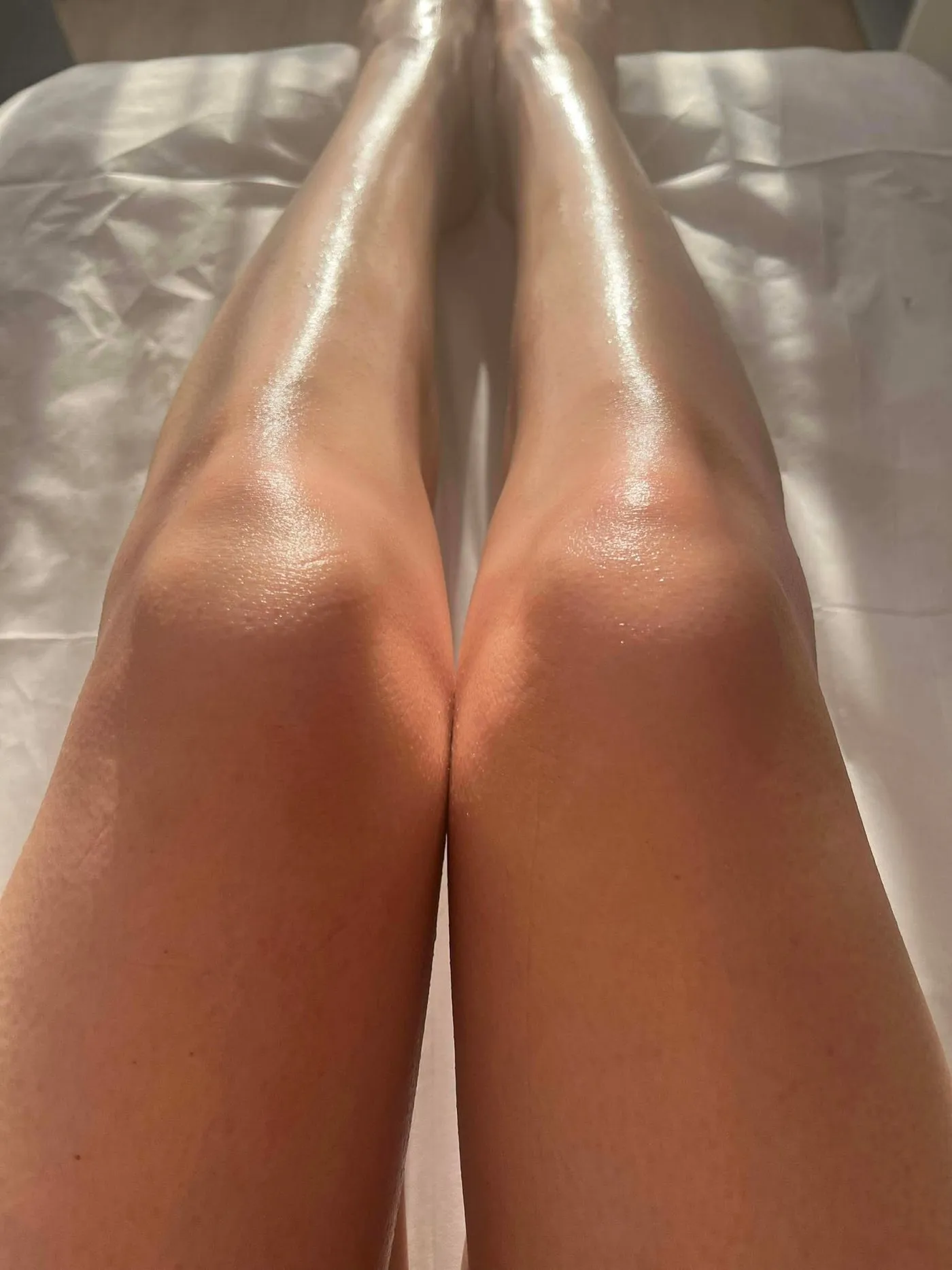 Lower legs, after