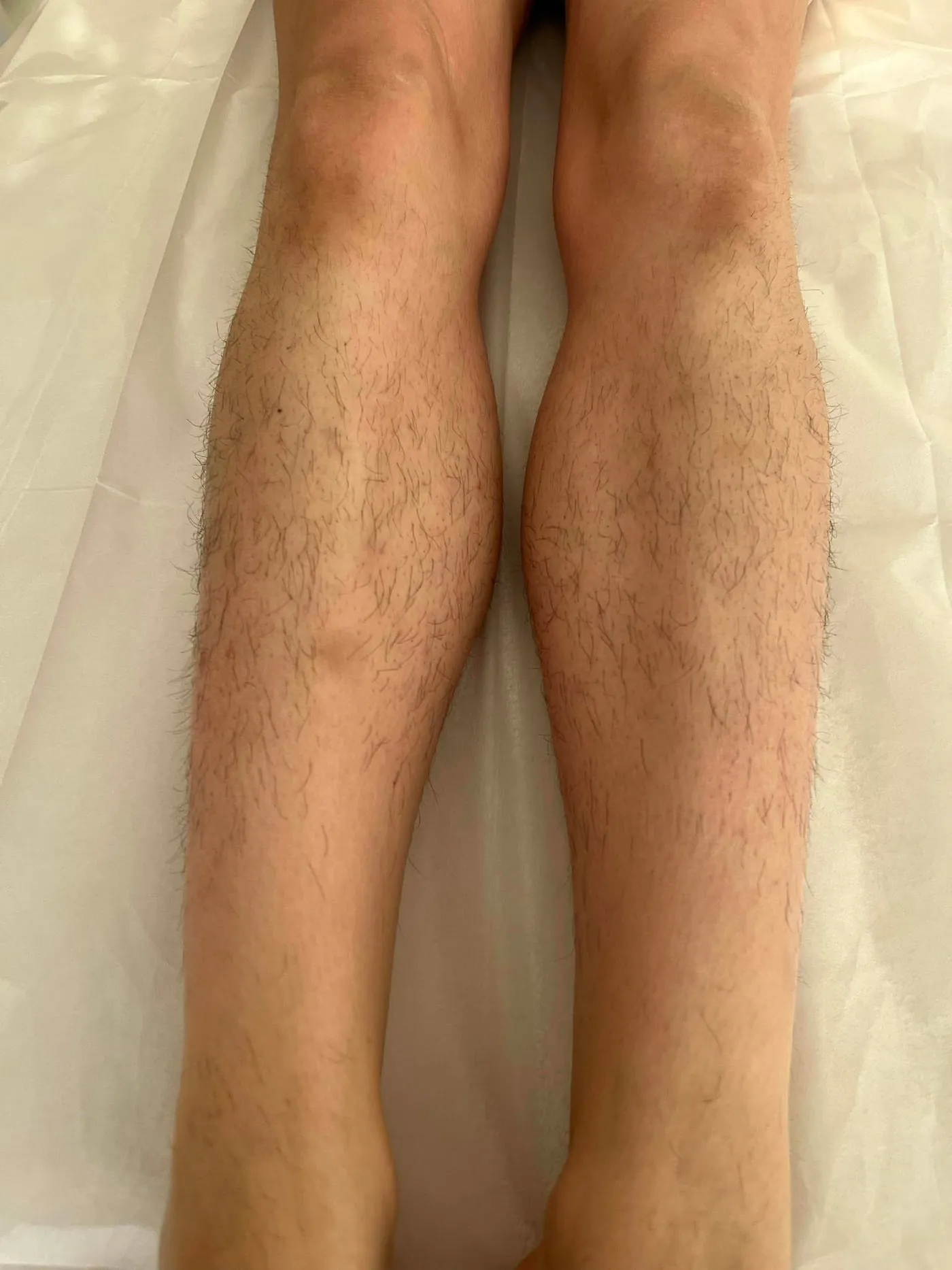 Lower legs, before