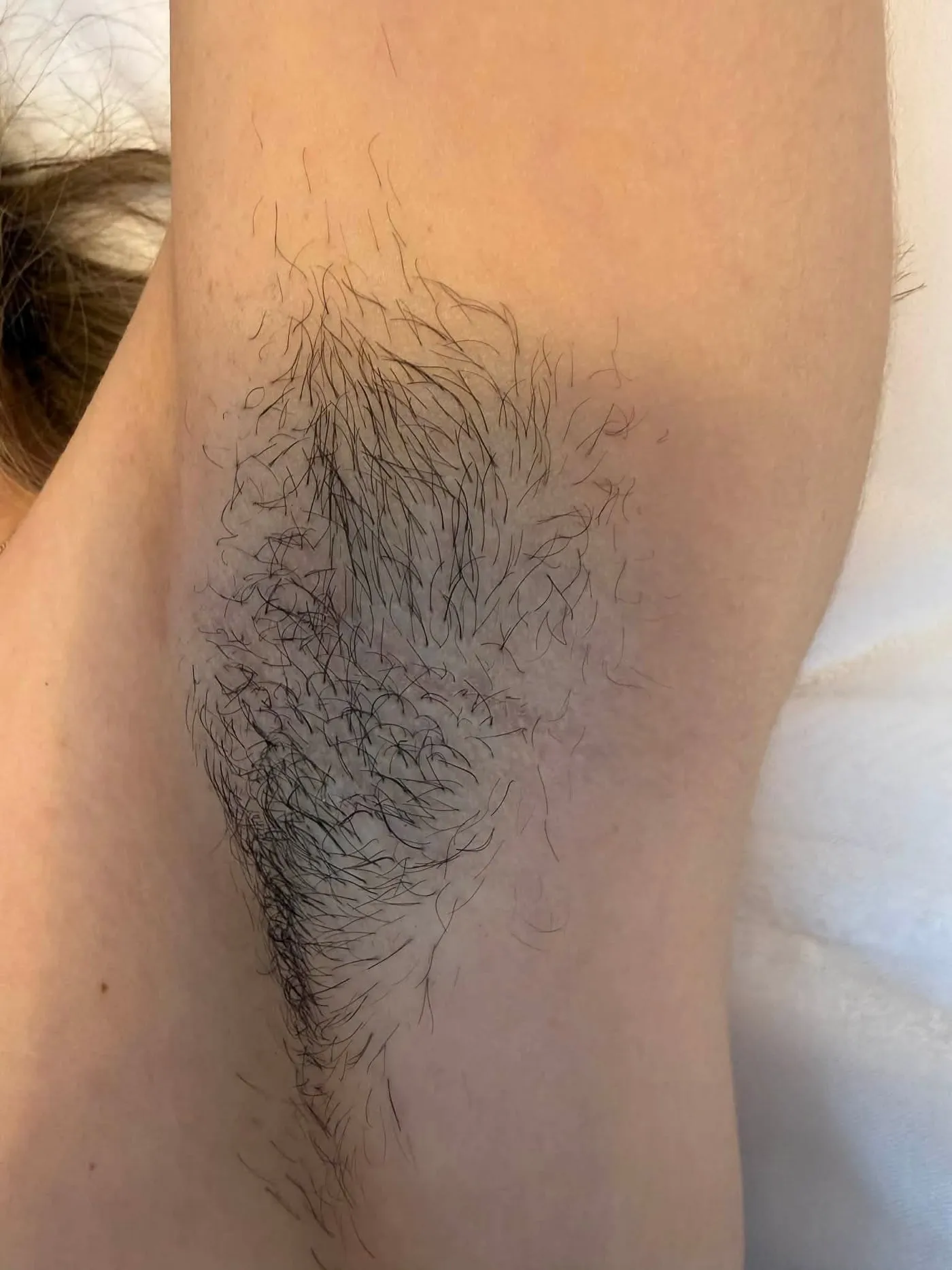 Underarms, before